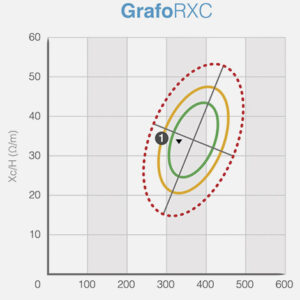 grafo rxc (1)